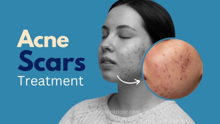 acne scars treatment in mulund