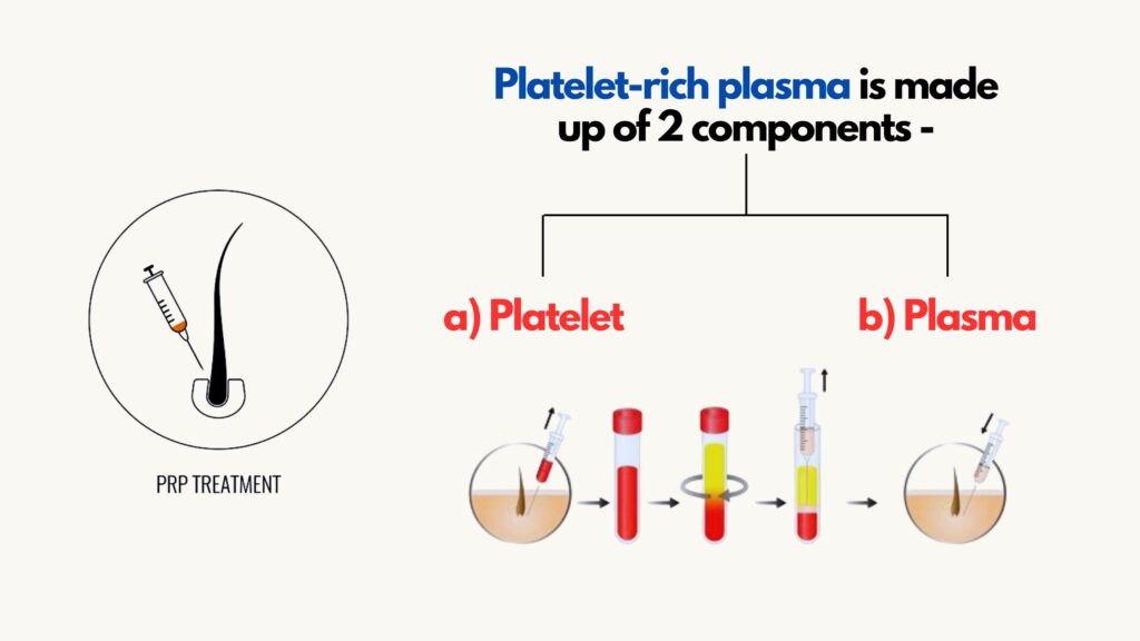 prp treatment procedure